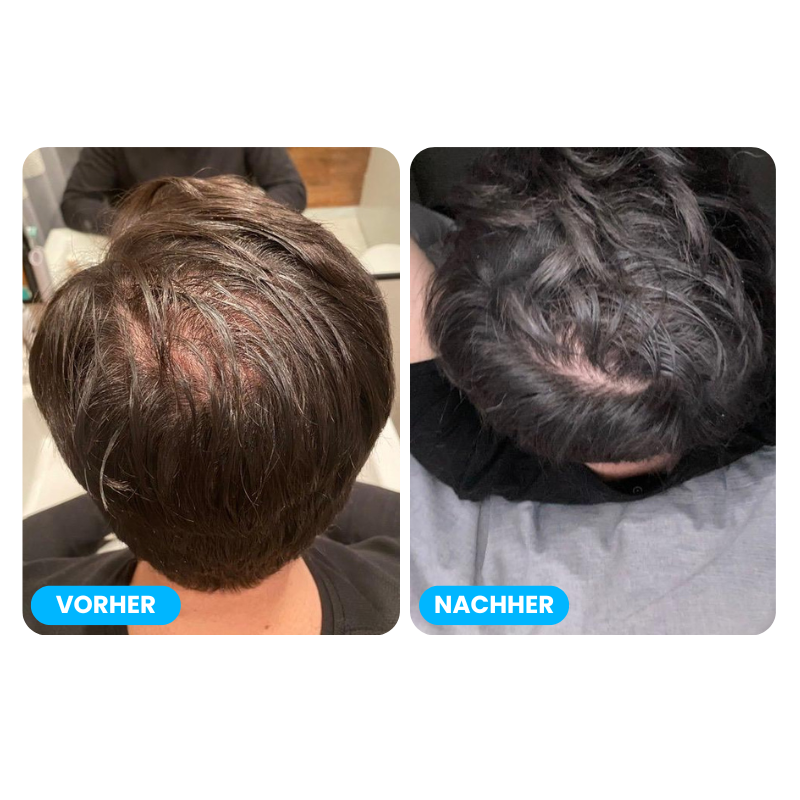 All-In-One Haarwuchsset